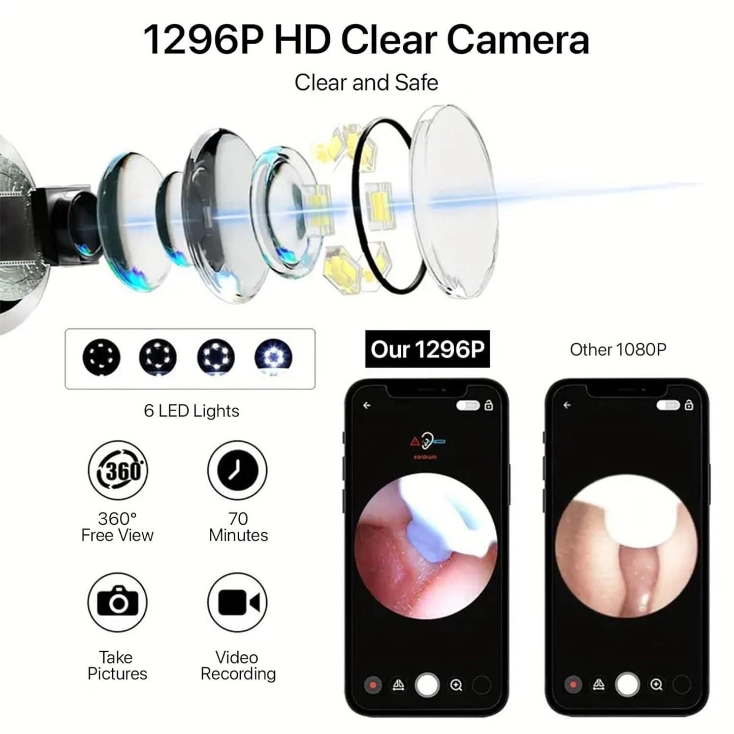 Next-Gen Ear Cleaner| Visual Ear Wax Cleaner